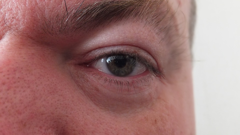 Operace očních víček neboli blefaroplastika