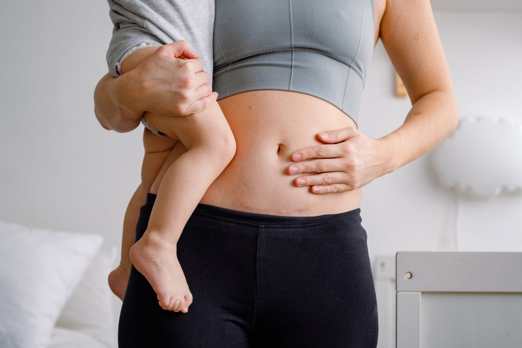 Duben, měsíc povědomí o císařských porodech: Podpora zdraví matek a dětí